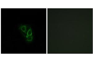 Immunofluorescence analysis of A549 cells, using RAD antibody. (RRAD Antikörper  (Internal Region))