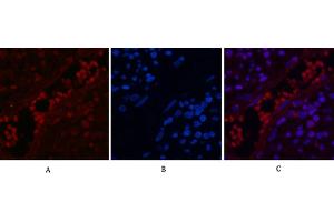 Immunofluorescence analysis of human appendix tissue. (NF-kB p65 Antikörper  (acLys310))