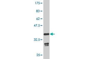 Western Blot detection against Immunogen (35. (GBX2 Antikörper  (AA 141-230))