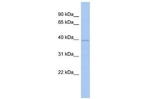 FLJ33790 antibody used at 1 ug/ml to detect target protein. (FLJ33790 (N-Term) Antikörper)