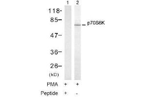 Image no. 1 for anti-Ribosomal Protein S6 Kinase, 70kDa, Polypeptide 1 (RPS6KB1) (Thr421) antibody (ABIN197499) (RPS6KB1 Antikörper  (Thr421))
