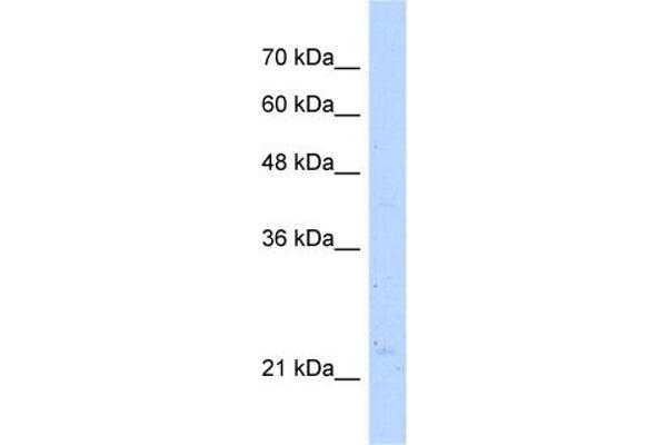 NUDT16L1 Antikörper  (C-Term)