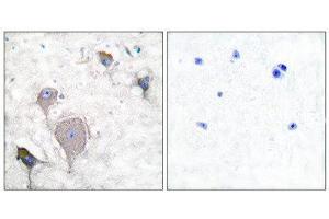 Immunohistochemistry (IHC) image for anti-Peripherin (PRPH) (C-Term) antibody (ABIN1848741) (Peripherin Antikörper  (C-Term))