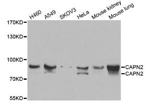 Western blot analysis of extracts of various cell lines, using CAPN2 antibody (ABIN5975337) at 1/1000 dilution. (Calpain 2 Antikörper)