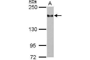 WB Image Sample (30 ug of whole cell lysate) A: THP-1 5% SDS PAGE antibody diluted at 1:2000 (ITGAL Antikörper  (Internal Region))