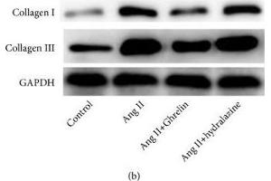 Western Blotting (WB) image for anti-Glyceraldehyde-3-Phosphate Dehydrogenase (GAPDH) (AA 1-335) antibody (ABIN3020538)