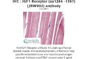 Image no. 1 for anti-Insulin-Like Growth Factor 1 Receptor (IGF1R) (AA 1264-1367) antibody (ABIN1723400) (IGF1R Antikörper  (AA 1264-1367))