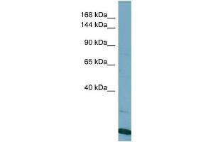 Host:  Rabbit  Target Name:  VPS8  Sample Type:  HT1080 Whole Cell lysates  Antibody Dilution:  1. (VPS8 Antikörper  (N-Term))