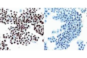 Immunohistochemical staining of SV40 large T, small t antigen. (SV40 Large T and Small Ts Antikörper (Biotin))