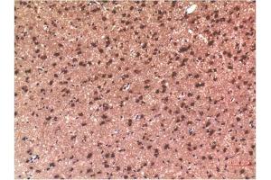 Immunohistochemical analysis of paraffin-embedded Rat Brain Tissue using Tau Mouse mAb diluted at 1:200. (tau Antikörper)