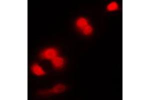 Immunofluorescent analysis of CDC2 staining in K562 cells. (CDK1 Antikörper  (Center))