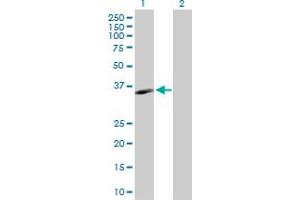 Western Blot analysis of MS4A1 expression in transfected 293T cell line by MS4A1 MaxPab polyclonal antibody. (CD20 Antikörper  (AA 1-297))