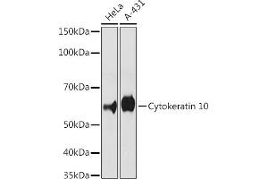 Western blot analysis of extracts of various cell lines, using Cytokeratin 10 antibody (ABIN1679404, ABIN3019133, ABIN3019134 and ABIN7101721) at 1:500 dilution. (Keratin 10 Antikörper)