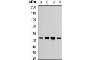 Western blot analysis of IFNGR1 expression in HEK293T (A), Hela (B), rat heart (C), rat brain (D) whole cell lysates. (IFNGR1 Antikörper)