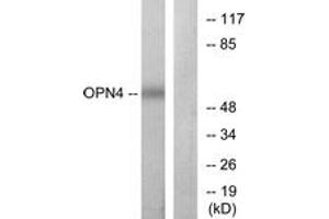 Western blot analysis of extracts from COLO cells, using OPN4 Antibody. (OPN4 Antikörper  (AA 429-478))