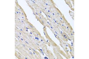 Immunohistochemistry of paraffin-embedded rat heart using RCN2 antibody. (RCN2 Antikörper)