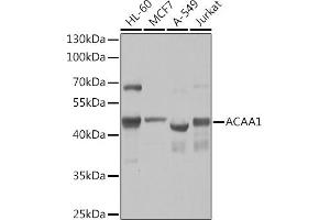 Western blot analysis of extracts of various cell lines, using  Rabbit pAb  at 1:1000 dilution. (ACAA1 Antikörper  (AA 27-300))