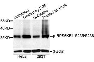 Western blot analysis of extracts of HeLa and 293T cells, using Phospho-RPS6KB1-S235/236 antibody (ABIN5995796) at 1/1000 dilution. (RPS6 Antikörper  (pSer235, pSer236))
