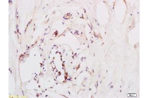 Immunohistochemistry (Paraffin-embedded Sections) (IHC (p)) image for anti-Chemokine (C-X-C Motif) Receptor 4 (CXCR4) (AA 201-294) antibody (ABIN730888)