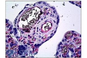 Immunohistochemistry (IHC) image for anti-Endothelium antibody (ABIN1107095) (Endothelium Antikörper)