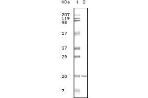 Western blot analysis using CD19 mouse mAb against CD19 recombinant protein. (CD19 Antikörper)