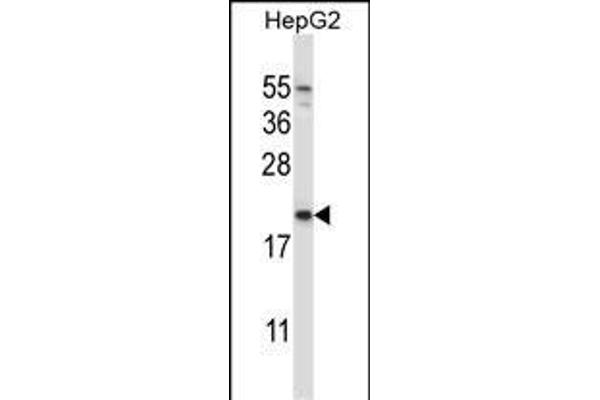 NDUFAF2 Antikörper  (AA 71-99)