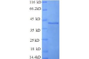 SDS-PAGE (SDS) image for Fibroblast Growth Factor Receptor 3 (FGFR3) (AA 23-375), (Extracellular) protein (His tag) (ABIN5709525) (FGFR3 Protein (AA 23-375, Extracellular) (His tag))