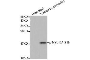 Western blot analysis of extracts from 293 cells untreated or treated with starvation using Phospho-MYL12A-S18 antibody (ABIN2988196). (MYL12A Antikörper  (pSer18))