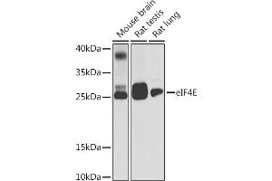 Western blot analysis of extracts of various cell lines, using eIF4E antibody (ABIN6134340, ABIN6140083, ABIN6140085 and ABIN6221700) at 1:1000 dilution. (EIF4E Antikörper  (AA 1-100))
