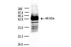 Western Blotting (WB) image for anti-SARS-Coronavirus Nucleocapsid Protein (SARS-CoV N) antibody (ABIN6952544)