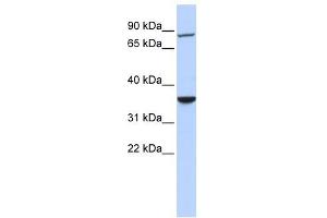 RNF207 antibody used at 1 ug/ml to detect target protein. (RNF207 Antikörper  (N-Term))