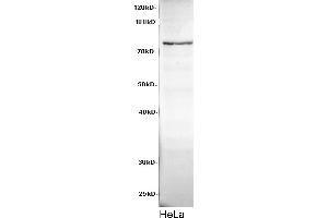 Western Blotting (WB) image for anti-Cadherin 8 (CDH8) antibody (ABIN5958176) (Cadherin 8 Antikörper)