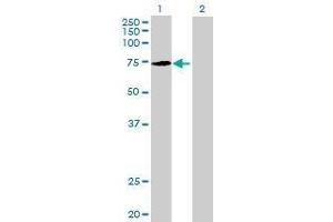 Lane 1: KLHL22 transfected lysate ( 71. (KLHL22 293T Cell Transient Overexpression Lysate(Denatured))