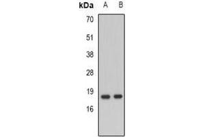Western blot analysis of NDP expression in mouse liver (A), mouse heart (B) whole cell lysates. (Norrie Disease (Pseudoglioma) Antikörper)