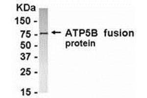 Western Blotting (WB) image for anti-ATP Synthase, H+ Transporting, Mitochondrial F1 Complex, beta Polypeptide (ATP5B) (AA 291-539) antibody (ABIN2468164) (ATP5B Antikörper  (AA 291-539))
