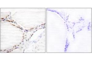Immunohistochemistry analysis of paraffin-embedded human thyroid gland tissue, using Vitamin D Receptor (Ab-208) Antibody. (Vitamin D Receptor Antikörper  (AA 181-230))