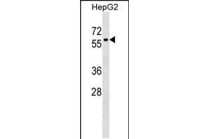 Western blot analysis in HepG2 cell line lysates (35ug/lane). (ZNF419 Antikörper  (AA 176-202))