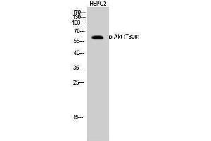 Western Blotting (WB) image for anti-V-Akt Murine Thymoma Viral Oncogene Homolog 1 (AKT1) (pThr308) antibody (ABIN3182380) (AKT1 Antikörper  (pThr308))