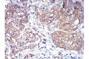 Immunohistochemistry (IHC) image for anti-RAB1B, Member RAS Oncogene Family (RAB1B) (AA 60-201) antibody (ABIN5875927) (RAB1B Antikörper  (AA 60-201))