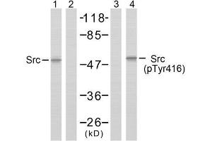 Western blot analysis of extracts from COLO205 cells using Src (Ab-418) antibody (E021115, Lane 1 and 2) and Src (phospho-Tyr418) antibody (E011091, Lane 3 and 4). (Src Antikörper)