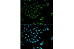Immunofluorescence analysis of MCF-7 cells using XRCC2 antibody (ABIN5970910). (XRCC2 Antikörper)