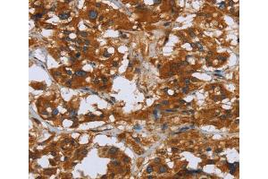 Immunohistochemistry (IHC) image for anti-Cartilage Oligomeric Matrix Protein (COMP) antibody (ABIN2429809) (COMP Antikörper)