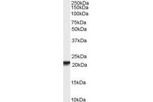 ABIN2564911 (0. (RBP4 Antikörper  (Internal Region))