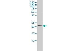 Western Blotting (WB) image for anti-Peroxiredoxin 2 (PRDX2) (AA 1-198) antibody (ABIN563132)