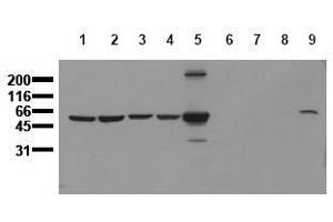 Western Blotting (WB) image for anti-Vimentin (VIM) antibody (ABIN126914) (Vimentin Antikörper)
