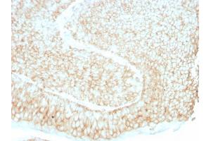 Formalin-fixed, paraffin-embedded human bladder stained with CD59 Mouse Monoclonal Antibody (193-27). (CD59 Antikörper)