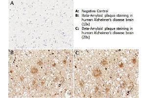 Immunohistochemistry (IHC) image for anti-Amyloid beta (Abeta) (N-Term) antibody (ABIN95037)