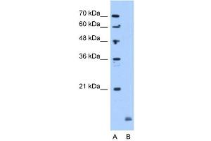 Crystallin Alpha B antibody used at 5 ug/ml to detect target protein. (CRYAB Antikörper  (C-Term))