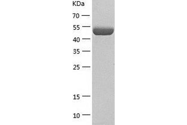 GORASP2 Protein (AA 1-452) (His tag)