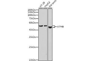 Western blot analysis of extracts of various cell lines, using B antibody (ABIN7265767) at 1:1000 dilution. (ATP4b Antikörper)